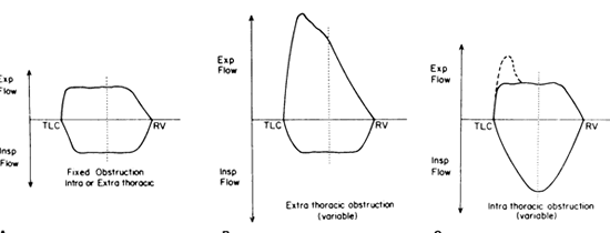 Flow-volume loops in intra and extrathoracic lesions